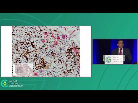 Invited Speaker Presentation-TP53 alterations in myelodysplastic neoplasms & acute myeloid leukemia