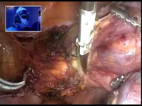 Se fa male il collo posteriore destro Che per consultare se il mal di schiena