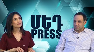 Ժամանակակից լապարասկոպիկ մեթոդ. Ի՞նչ է այն