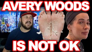 Avery Woods Is Not Doing Well During Her Cancellation. Eats Her Foot Skin