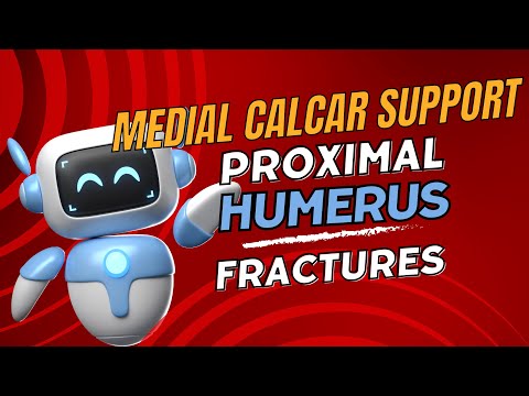 OrthoConcepts - Proximal Humerus Medial Calcar Support