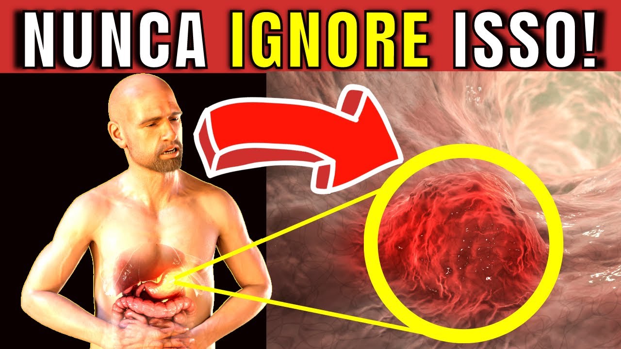 7 WARNING SYMPTOMS of STOMACH CANCER that you CAN NEVER IGNORE!