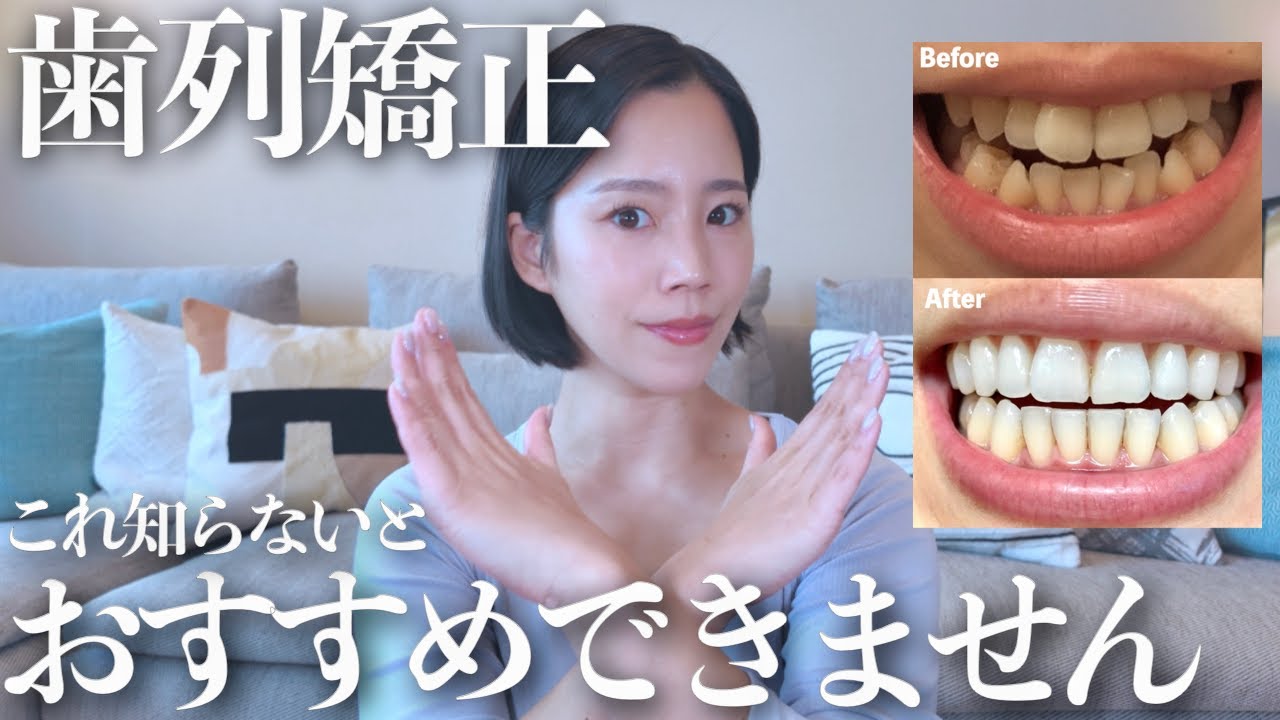 【歯列矯正の真実】これできない人は歯の矯正オススメしません！