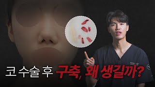 코 수술 후 구축, 왜 생길까? | 늑떼선생김현주