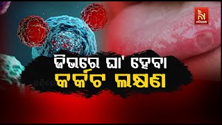 ଜିଭରେ ଘା’ ହେବା କର୍କଟ ଲକ୍ଷଣ |