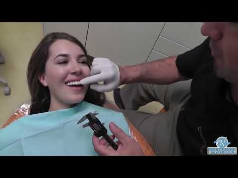 Video about porcelain veneers