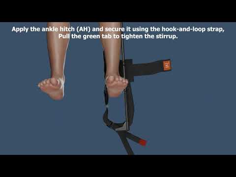 Giraffe Traction Splint