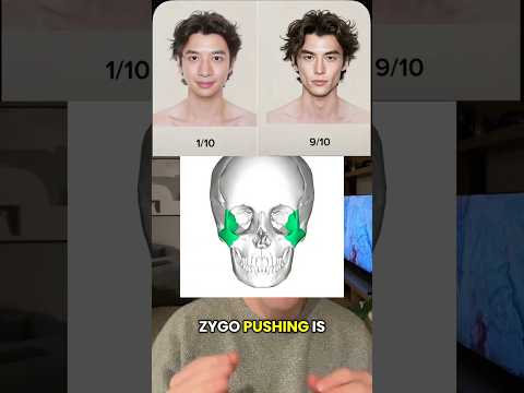 Zygo Pushing - part 1 #jawline