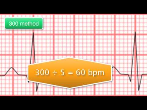 ECG Basics 5/10 - Rate Calculation