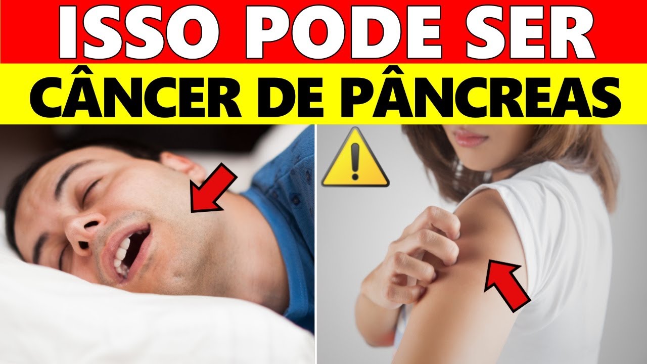 NÃO IGNORE! 10 Sintomas Desconhecidos Do Câncer De Pâncreas Que Poucas Pessoas Percebem!