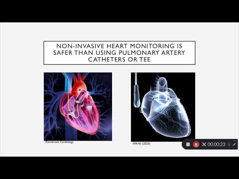 Cheetah NICOM Monitor: Seeing the Unseen by Thomas Knowles, MD Candidate Class of 2022