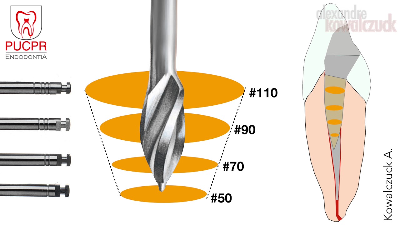 Técnica de Preparo Manual do Canal Radicular - Endodontia PUCPR