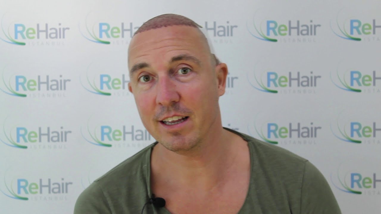 ReHair Istanbul - Review - Haartransplantatie in Istanbul, Turkije
