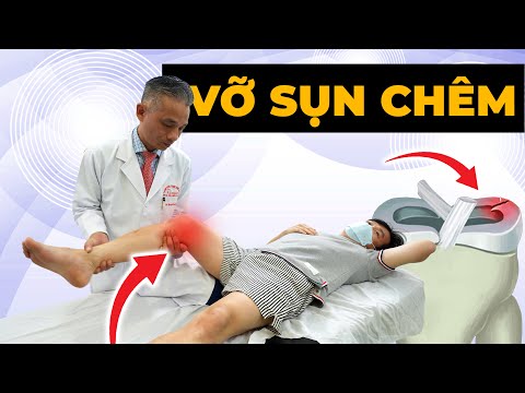 Vỡ Ngang Sụn Chêm Gối - Con Đường ĐAU ĐỚN Dẫn Đến Tàn Phế?