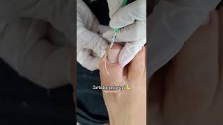 Técnicas de corte bordado no pé