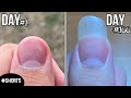 100 Days Of Fingernail Growth - Time Lapse #shorts