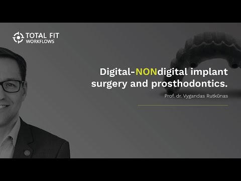 Digital-NONdigital implant surgery and prosthodontics Digital-NONdigital implant surgery and prosthodontics