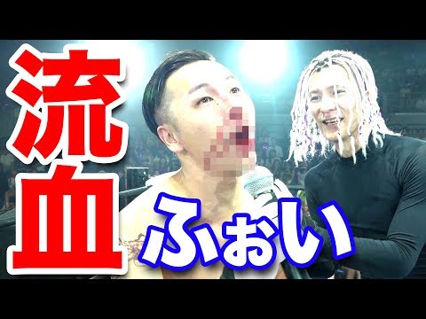 【レペゼン地球】ふぉいとガチで殴りあったら顔面骨折！【炎上万博】