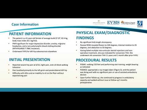 Thumbnail image of video presentation for Conversion of prior Fibular Bone Graft to Total Hip Arthroplasty via the Anterior Approach