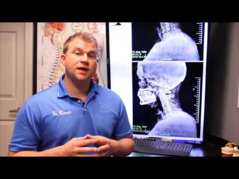 The Importance of the Motion Study X-Ray
