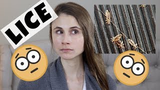 Head lice treatment at home| Dr Dray