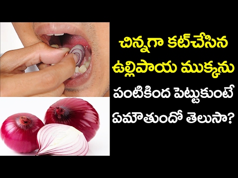 Is Onion good for TEETH Pain? | How can Onion Cure Teeth Pain | Health Tips | Vtube Telugu Video