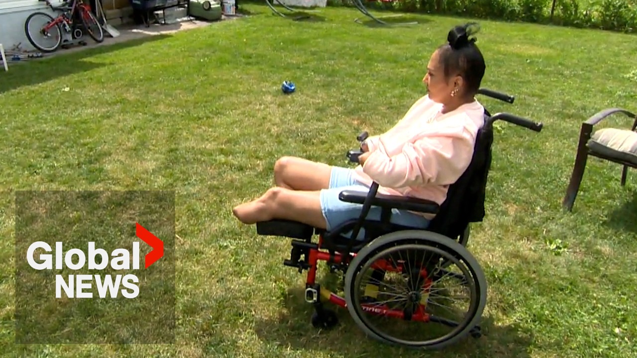 Video: Chameleia Ramdas loses hands and legs after Capnocytophaga sepsis in Montreal