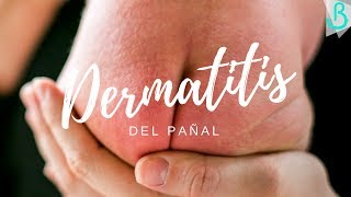 🍑🐛 DERMATITIS DEL PAÑAL - Cuidados y causas || Baby Suite by Pau