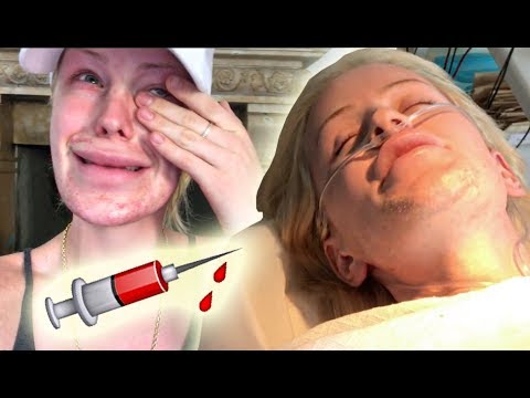 permanent facial hair removal + insecurities (graphic) | Gigi
