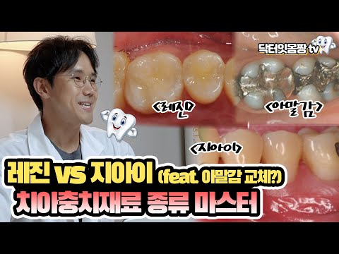 레진 (비보험)? 지아이(보험)? 아말감(보험)? - 충치치료 수복재료  비용.장점.단점 (resin vs GI)
