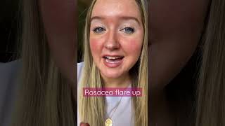 Rosacea flare up, close up 💖 #redness #rosacea #rosaceaawareness #rosaceawithrose #sensitiveskin