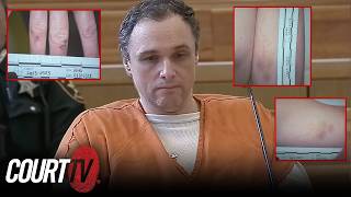 Surgeon Accused of Murder Had Bruises All Over His Body: Deputy
