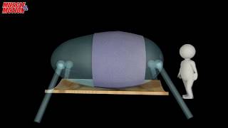 Abdominal Bracing