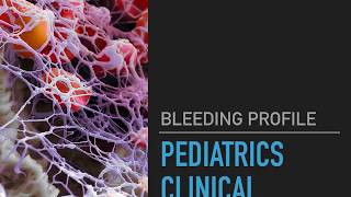 Bleeding profile - Endround Cinical Pediatrics 2017