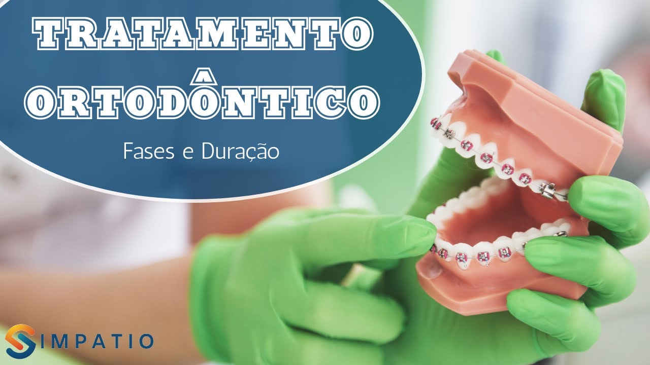 CONHEÇA O TRATAMENTO ORTODÔNTICO E SUAS 6 ETAPAS