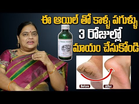 Amazing Home Remedies for Cracked Heels Treatment | In 3 Days Reduce Cracked Heels completely