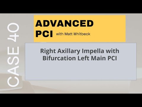 Case 40   Right Axillary Impella with Left Main PCI