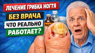 Лечение грибка ногтей | Опасные ошибки, которые делают все