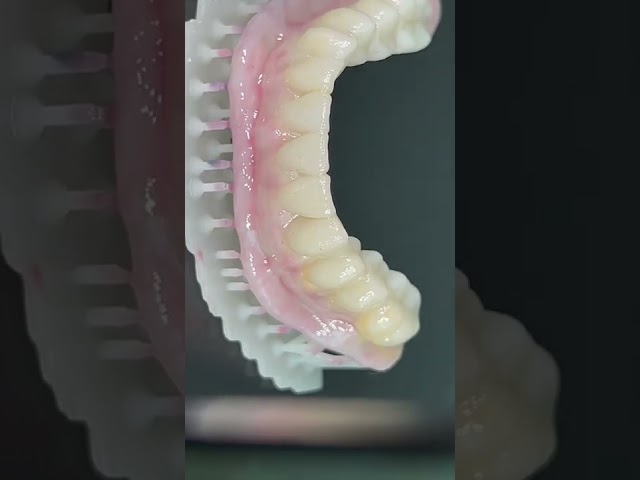 Vídeo relacionado con Creación rápida de prototipos en prostodoncia: Impresión 3d