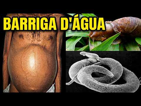 Barriga d\'Água: O drama das doenças negligenciadas no Brasil