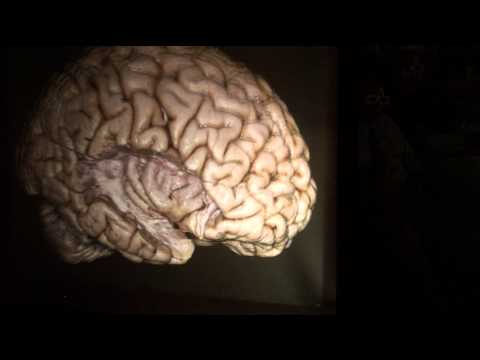 The Brain Surface: Sulci & Gyri by Guilherme Carvalhal Ribas, M.D.