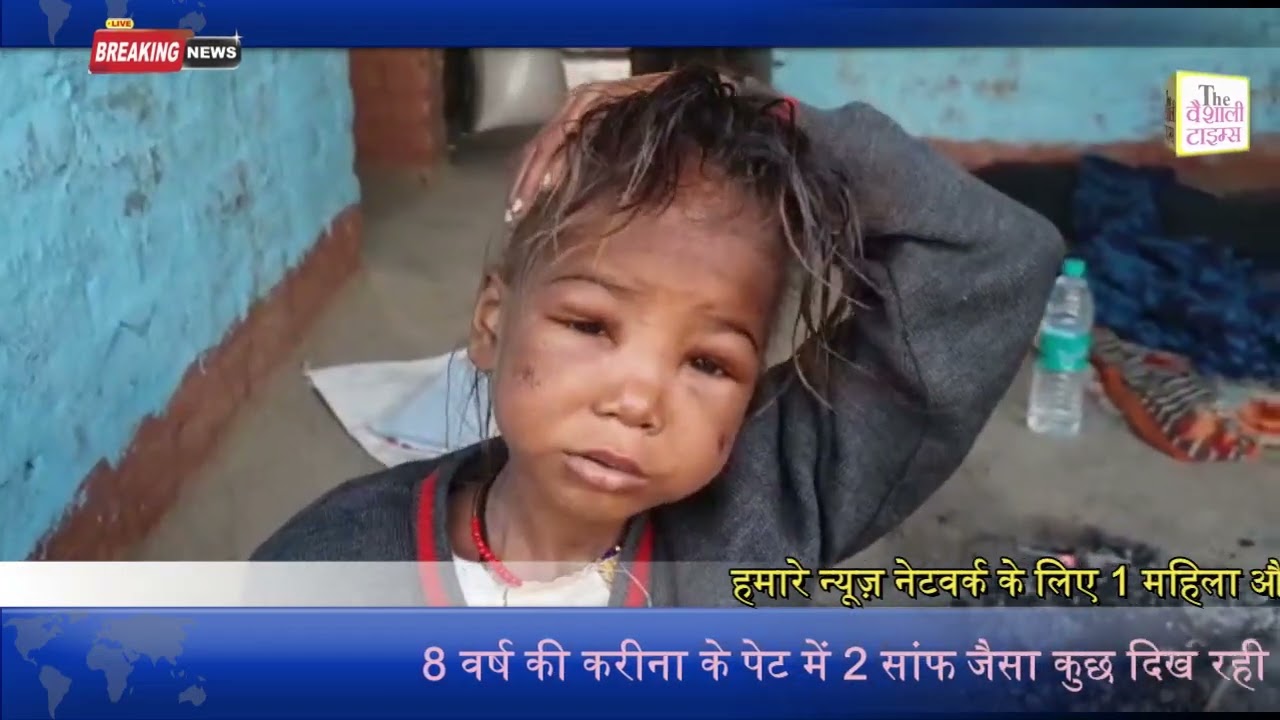 8 वर्ष की करीना के पेट में 2 सांफ जैसा कुछ दिख रही है डॉक्टरों ने एक्स - रे देख कर दी जानकारी