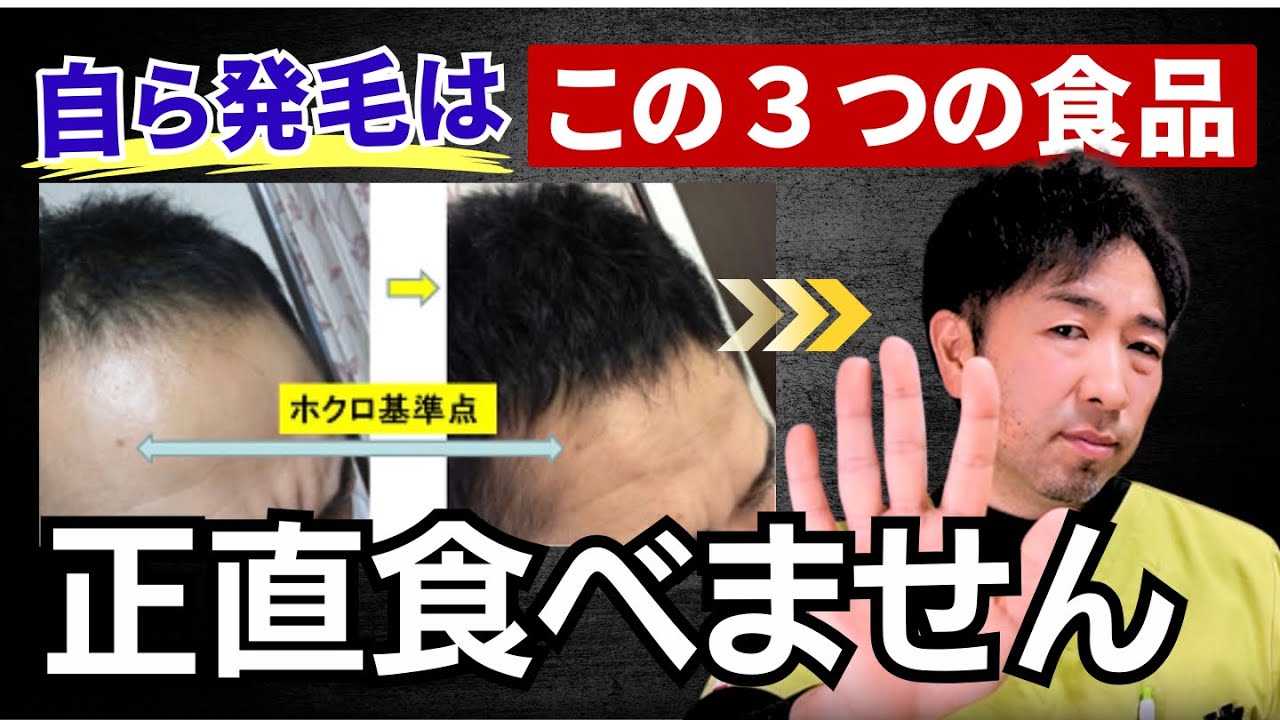 【薄毛対策】これは極力控えるべき。発毛のプロがお勧めしない3つの食品