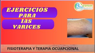 EJERCICIOS PARA LAS VARICES