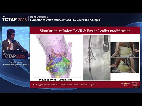 [TCTAP 2023] TCTAP Workshops - Evolution of Valve Intervention (TAVR, Mitral, Tricuspid)