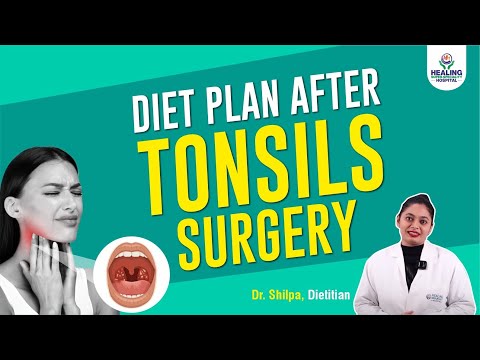 Diet Plan After Tonsil Removal Surgery | What to Eat After Surgery for Faster Healing