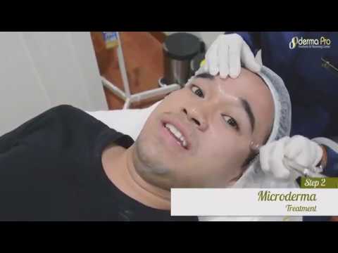 ANWAR BAB TERIMA TANTANGAN SUPER DIAMOND GLOWING