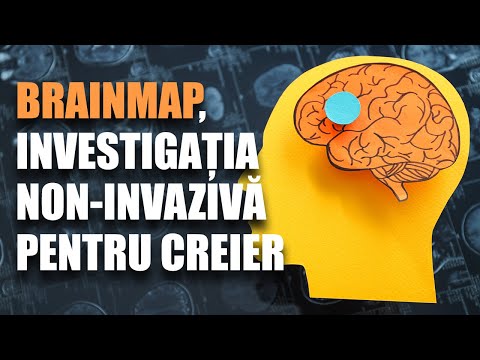 BrainMap, cea mai complexă investigație non-invazivă pentru creier