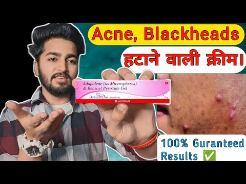 Finished Product Adapalene & Hydrous Benzoyl Peroxide Gel