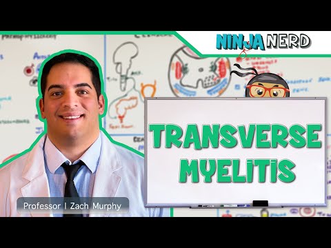 Stroke Syndromes MCA ACA ICA PCA Vertebrobasilar Artery Strokes Pathophysiology